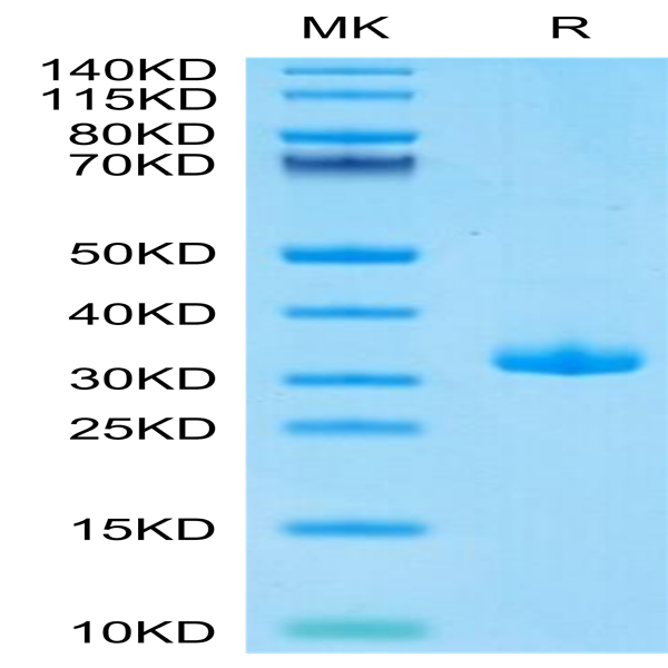 Biotinylated Human BTN3A1/CD277 Protein (BTN-HM4A3B)