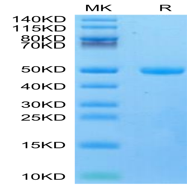 Mouse CYTL1/C17 Protein (C17-MM217)