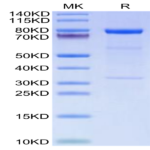Human Complement Component C1s Protein BP003585 Syd Labs