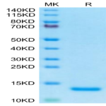 Human Complement C5a Protein BP003887 Syd Labs