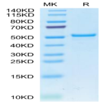 Cynomolgus CA9/Carbonic Anhydrase IX Protein (CA9-CM101)
