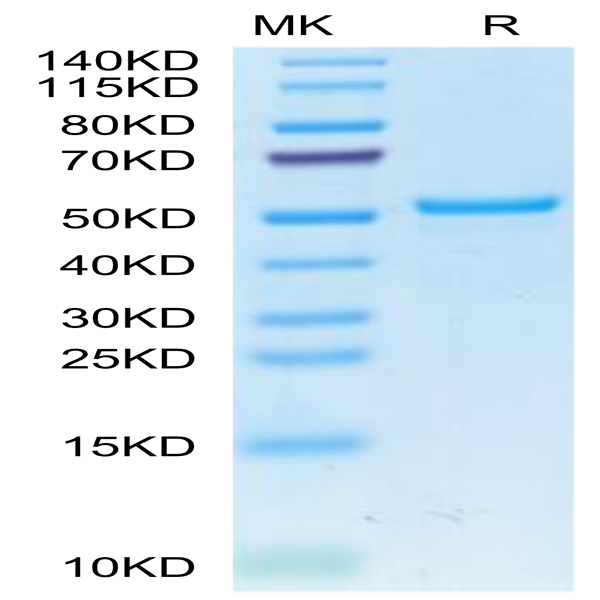 Cynomolgus CA9/Carbonic Anhydrase IX Protein (CA9-CM101)