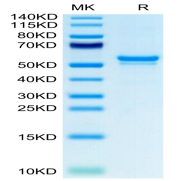 Human CA9/Carbonic Anhydrase IX Protein (CA9-HM401)