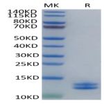 Human Calprotectin (S100A8&S100A9) Protein BP005588 Syd Labs