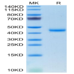 Mouse CALCA/CGRP Protein (CAL-MM201)