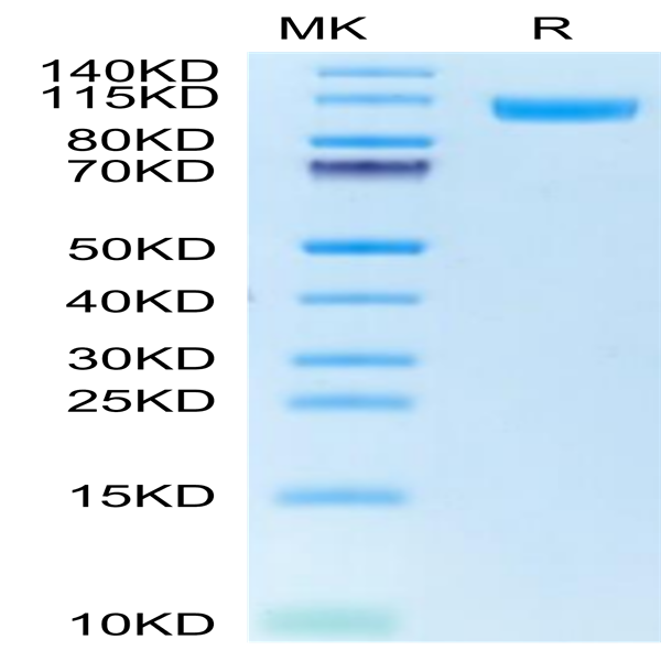 Human NCAM-1/CD56 Protein (CAM-HM156)