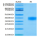 Human EpCAM/TROP1 Protein (CAM-HM1EP)