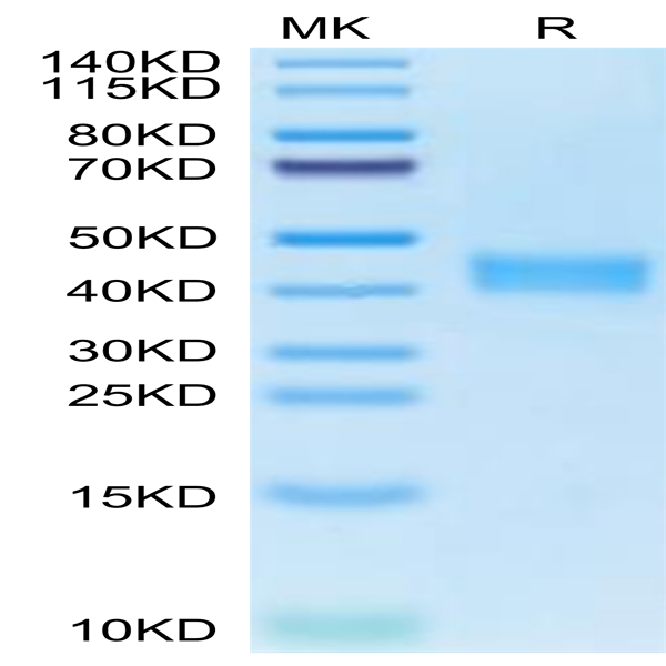 Human carbonic anhydrase XII Protein (CAS-HM112)