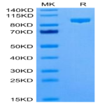 Cynomolgus Complement Component C2 Protein (CC2-CM101)