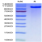 Mouse PTK7/CCK4 Protein (CCK-MM104)