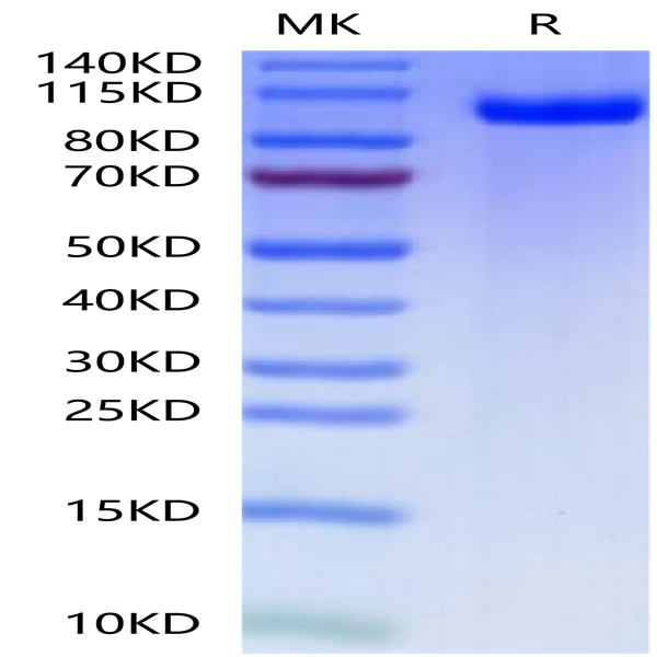 Mouse PTK7/CCK4 Protein (CCK-MM104)