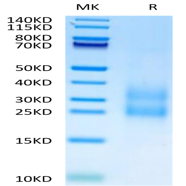 Cynomolgus CCL24 Protein (CCL-CM124)