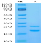 Human CCL5 Protein (CCL-HE105)