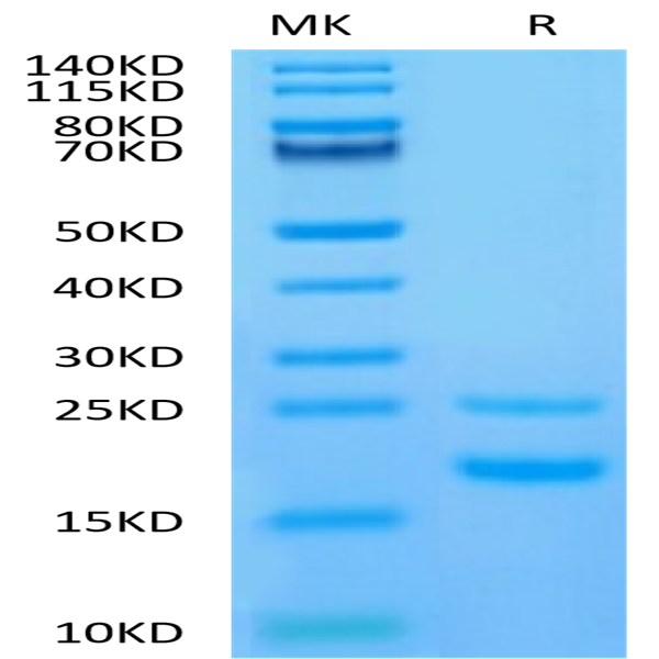 Human CCL5 Protein (CCL-HE105)