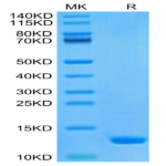 Human CCL8 Protein BP003998 Syd Labs