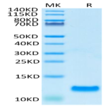 Human CCL20 Protein BP005124 Syd Labs