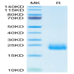 Human CCL24 Protein (CCL-HM124)