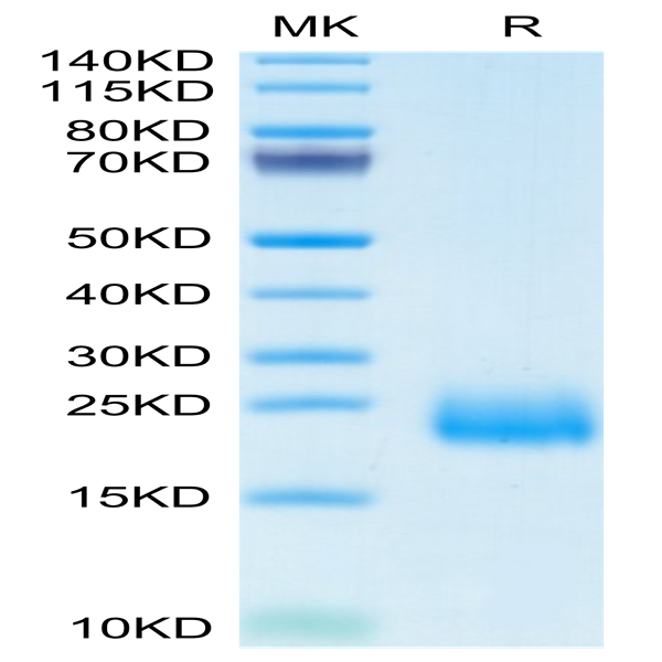 Human CCL24 Protein (CCL-HM124)