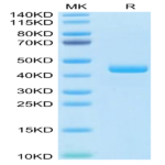 Human CCL24 Protein (CCL-HM224)