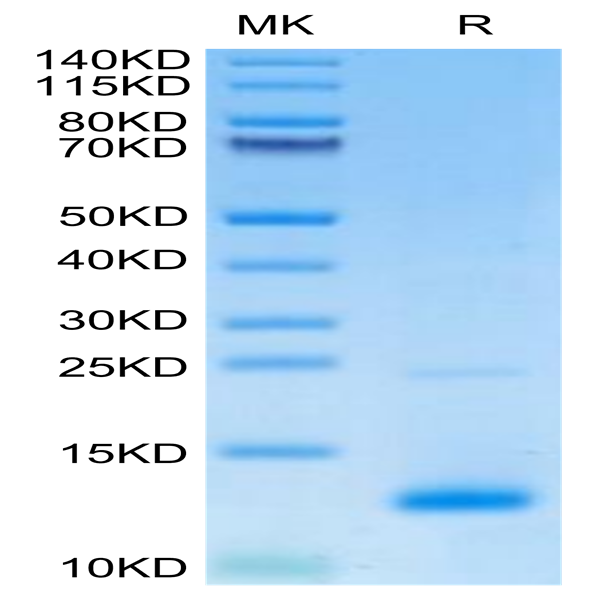 Mouse CCL8 Protein (CCL-ME108)