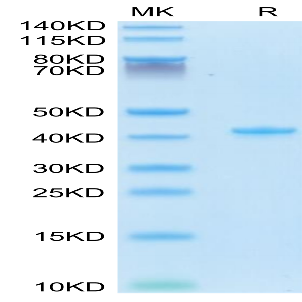 Mouse CCL5 Protein (CCL-MM205)