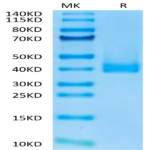 Cynomolgus CCR8 Protein (CCR-CM308)
