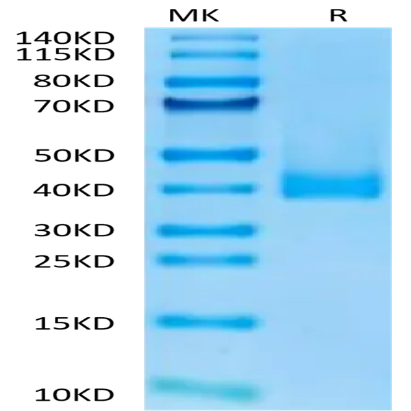 Cynomolgus CCR8 Protein (CCR-CM308)