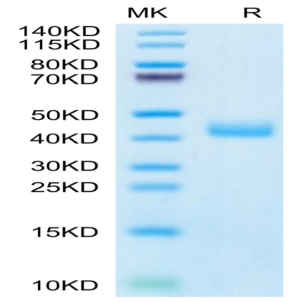 Human CCR8 Protein (CCR-HM208)