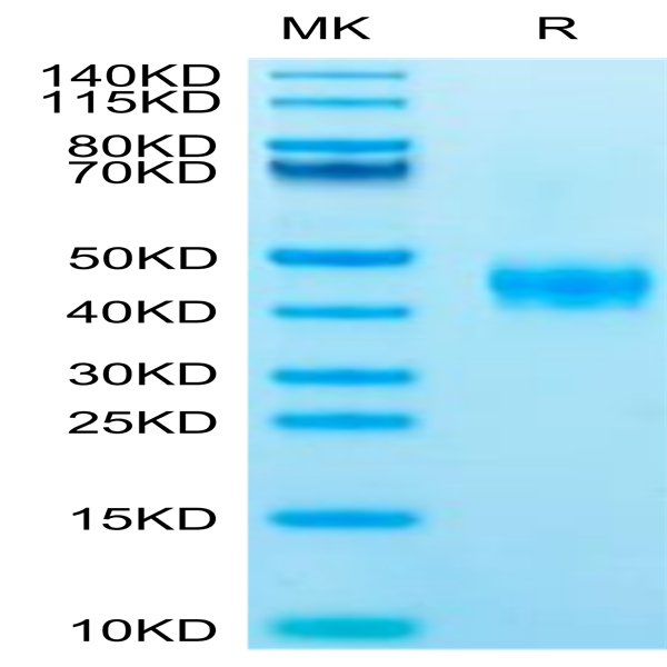 Human CCR8 Protein (CCR-HM308)
