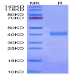 Cynomolgus IL-2 R beta/CD122 Protein (CD1-CM122)