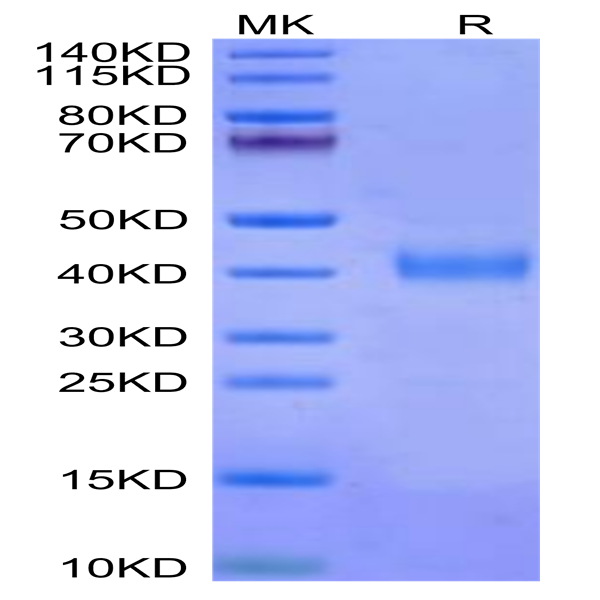 Cynomolgus IL-2 R beta/CD122 Protein (CD1-CM122)