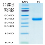 Biotinylated Cynomolgus CD161 Protein (CD1-CM461B)