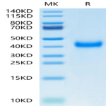 Human CD161 Protein (CD1-HM161)