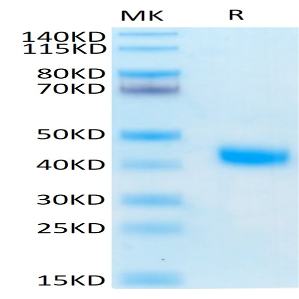 Human IL-2 R beta/CD122 Protein (CD1-HM422)