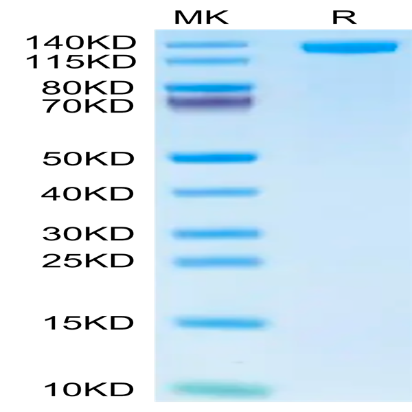 Human CD163 Protein (CD1-HM463)