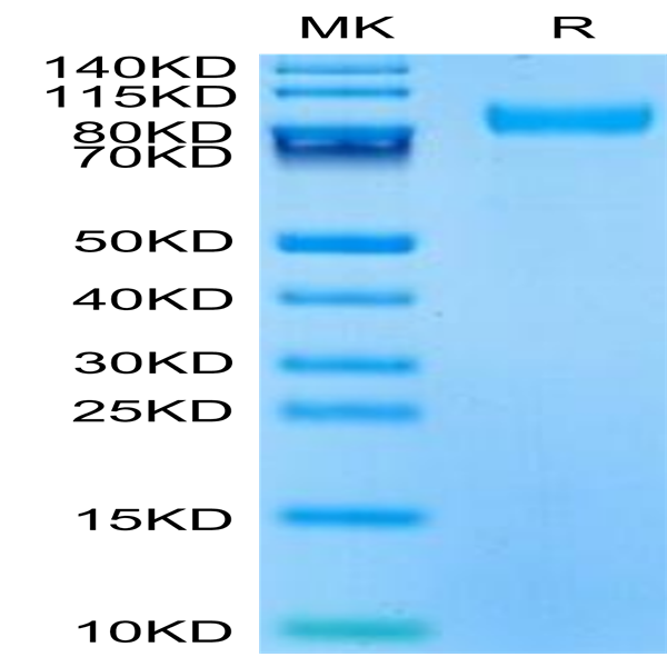 Mouse CD180 Protein (CD1-MM180)