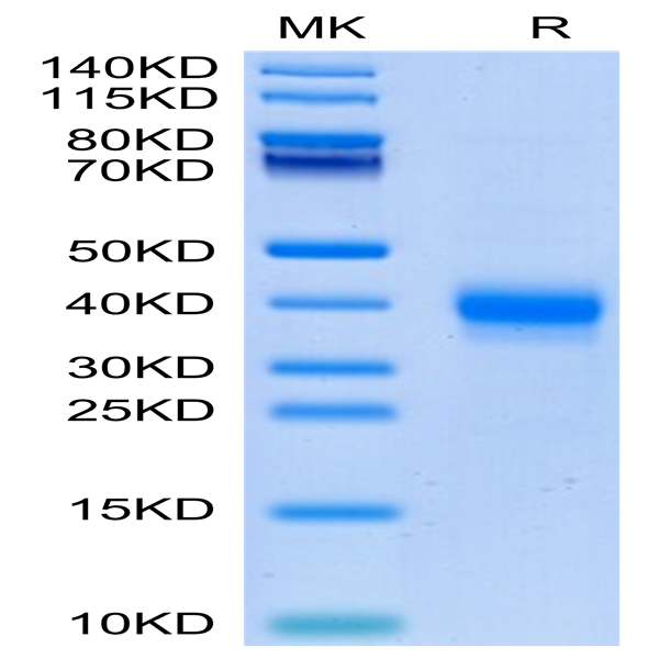 Cynomolgus CD2/SRBC Protein (CD2-CM202)