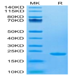Human CD20/MS4A1 Protein (CD2-HE120)