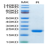 Biotinylated Human CD20/MS4A1 Protein (CD2-HE120B)