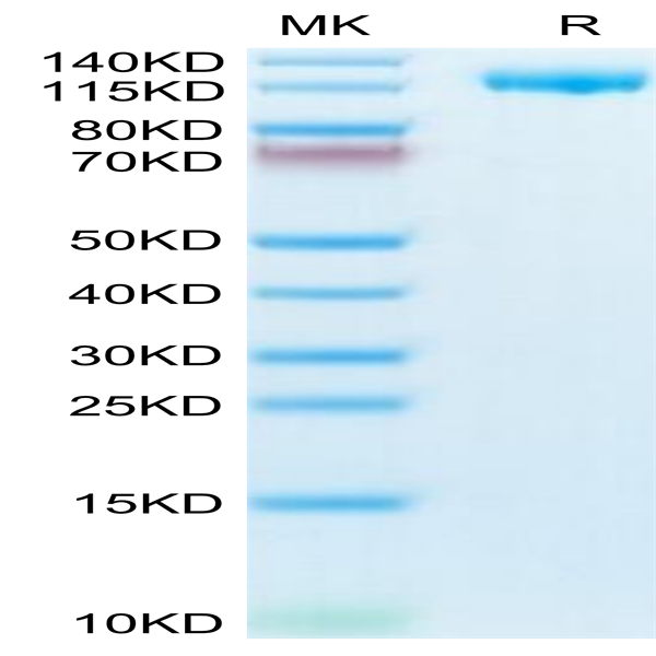 Human CD21 Protein (CD2-HM121)