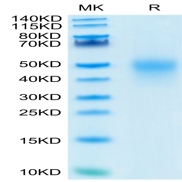 Human CD27/TNFRSF7 Protein (CD2-HM127)