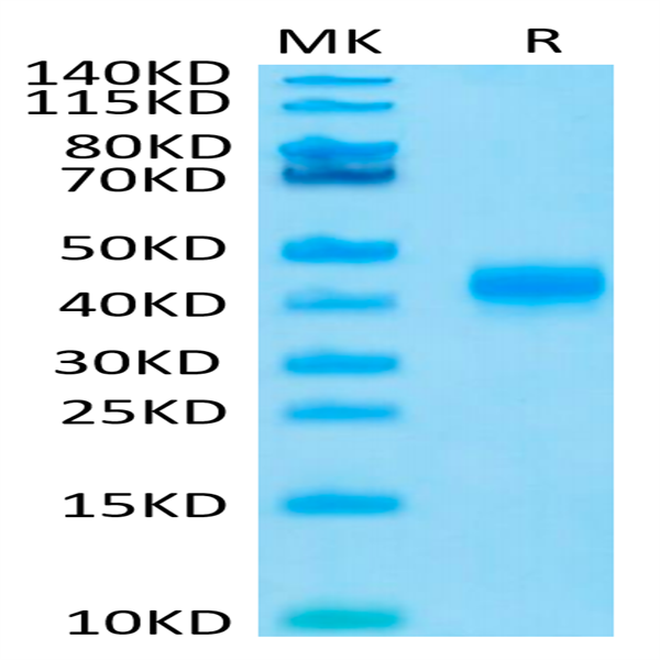 Human CD23/Fc epsilon RII Protein (CD3-HM123)