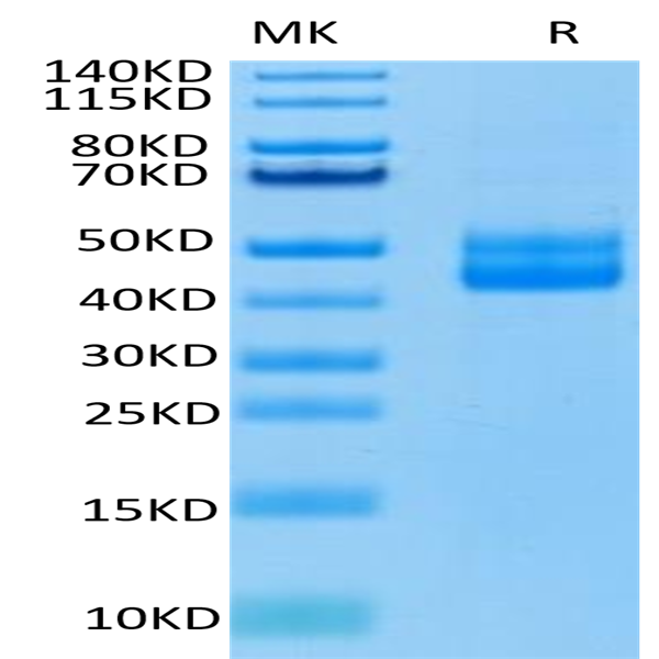 Human CD3E/CD3 epsilon Protein (CD3-HM20E)