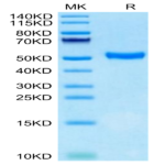 Human CD5 Protein (CD5-HM101)