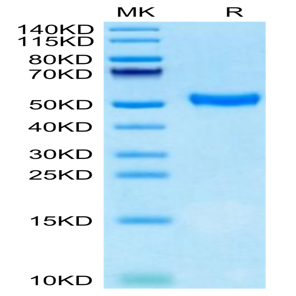 Human CD5 Protein (CD5-HM101)