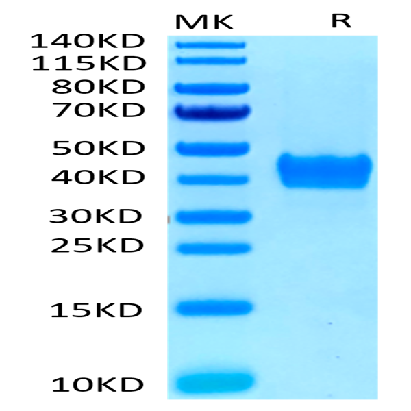 Human CD52 Protein (CD5-HM352)