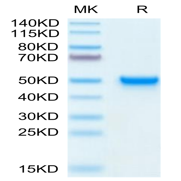 Mouse CD5L Protein (CD5-MM10L)