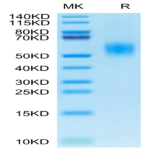 Mouse IL-2 R alpha/CD25 Protein (CD5-MM125)