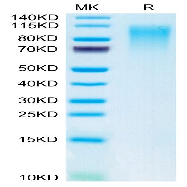 Mouse CD164 Protein (CD6-MM204)
