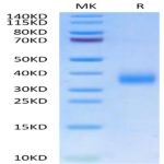 Human CD72 Protein BP003428 Syd Labs